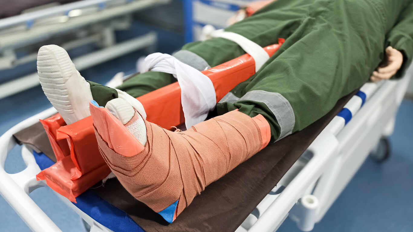 Person with a leg cast and splint lying on an emergency stretcher, symbolizing a catastrophic injury.