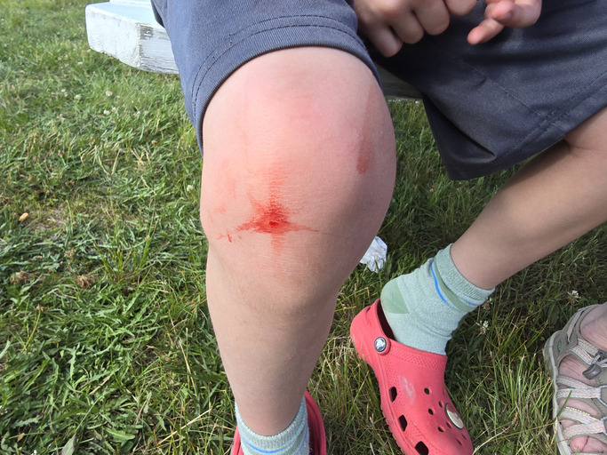 Minor Injuries Reported